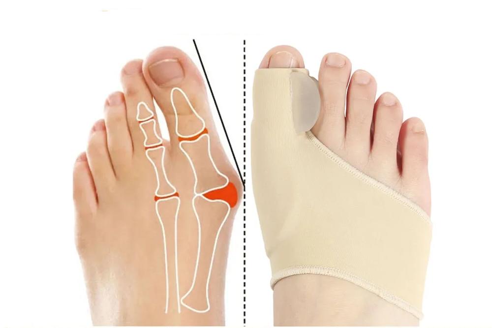 Toe Separator Hallux Valgus Bunion Corrector Orthotics Feet Bone Thumb Adjuster Correction Pedicure Sock Straightener