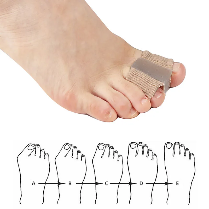 1Pcs Silicone Toe Spreader Separator Bunion Hallux Valgus Corrector Thumb Finger Correction Straightener Foot Care Tool 1Pcs Silicone Toe Spreader Separator Bunion Hallux Valgus Corrector Thumb Finger Correction Straightener Foot Care Tool